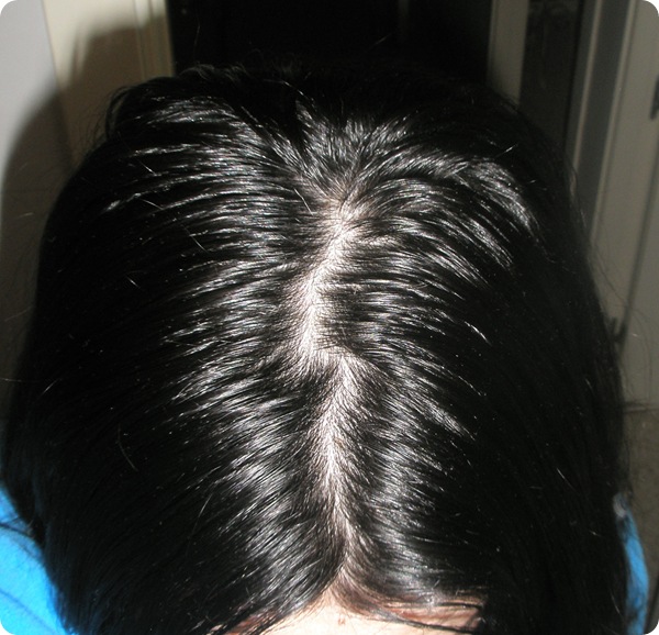 La máscara para la cabeza de la caída de los cabello con la cebolla